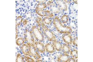 Immunohistochemistry of paraffin-embedded rat kidney using HMGCL antibody. (HMGCL anticorps  (AA 1-325))