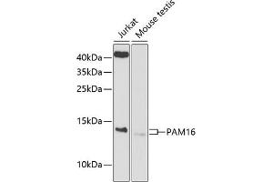 Western blot analysis of extracts of various cell lines, using P antibody (ABIN6133374, ABIN6145200, ABIN6145201 and ABIN6225214) at 1:1000 dilution. (MAGMAS anticorps  (AA 21-125))