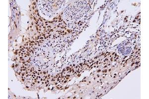 IHC analysis of PHF21A using anti-PHF21A antibody (ABIN6719353). (PHF21A anticorps  (AA 1-97))