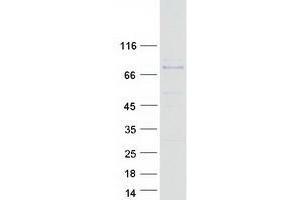 Validation with Western Blot
