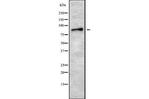 Western blot analysis of ADAM8 using HepG2 whole cell lysates