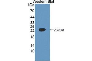 Figure. (SHISA4 anticorps  (AA 28-197))