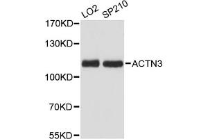 Western blot analysis of extracts of various cell lines, using ACTN3 antibody (ABIN6290056) at 1:3000 dilution. (ACTN3 anticorps)