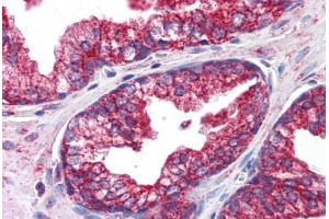 Human Prostate: Formalin-Fixed, Paraffin-Embedded (FFPE) (OCIAD1 anticorps  (C-Term))
