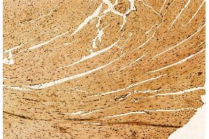 ABIN6263924 and ABIN6272926 at 1/100 staining Mouse heart tissue by IHC-P.