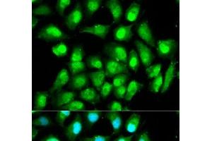 Immunofluorescence analysis of HeLa cells using RAN Polyclonal Antibody (RAN anticorps)
