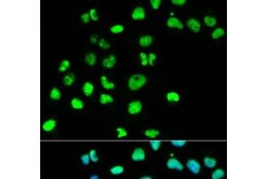 Immunofluorescence analysis of HeLa cells using MSH6 Polyclonal Antibody (MSH6 anticorps)
