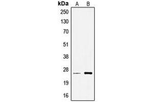 Western blot analysis of TCEAL6 expression in A549 (A), Jurkat (B) whole cell lysates. (TCEAL6 anticorps  (Center))