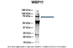 Amount and Sample Type :  500 ug mouse brain homogenate  Amount of IP Antibody :  6 ug  Primary Antibody :  WB Primary Antibody Dilution :  1:500  Secondary Antibody :  Goat anti-rabbit Alexa-Fluor 594  Secondary Antibody Dilution :  1:5000  Gene Name :  WB Submitted by :  Dr. (WBP11 anticorps  (N-Term))