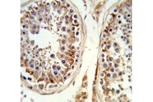 IHC analysis of FFPE human testis tissue stained with the Integrin beta 3 antibody (Integrin beta 3 anticorps  (AA 734-760))