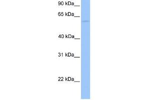 WB Suggested Anti-CCT6B Antibody Titration: 0.