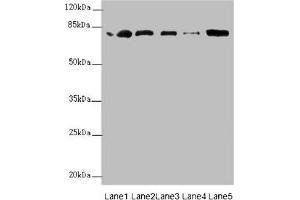 Western blot All lanes: ZBTB48 antibody at 0. (ZBTB48 anticorps  (AA 1-280))