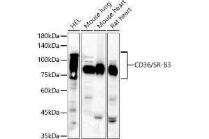 Western blot analysis of extracts of various cell lines, using CD36/SR-B3 antibody (ABIN6132248, ABIN6138173, ABIN6138174 and ABIN6221473) at 1:810 dilution.