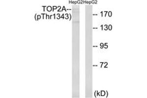 Western blot analysis of extracts from HepG2 cells treated with Ca2+ 40nM 30', using TOP2A (Phospho-Thr1343) Antibody. (Topoisomerase II alpha anticorps  (pThr1343))