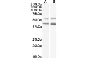 Western Blot using anti-CCR4 antibody KW-0761 (Mogamulizumab). (Recombinant CCR4 (Mogamulizumab Biosimilar) anticorps)