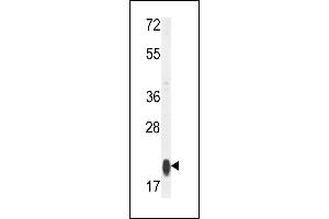 Western blot analysis of RT25 Antibody (C-term) (ABIN653808 and ABIN2843083) in MCF-7 cell line lysates (35 μg/lane). (MRPS25 anticorps  (C-Term))