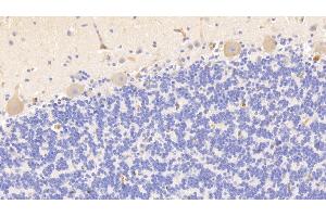 Detection of HB in Human Cerebellum Tissue using Polyclonal Antibody to Hemoglobin (HB) (Hemoglobin anticorps)