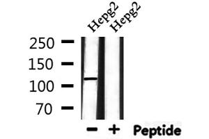 Western blot analysis of extracts from HepG2, using UBAP2L Antibody.