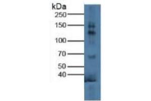 Rabbit Detection antibody from the kit in WB with Positive Control:  Sample Mouse testis lysate.