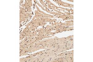 Immunohistochemical analysis of paraffin-embedded Mouse heart tissue using (ABIN6243913 and ABIN6577986) performed on the Leica® BOND RXm.