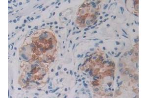 Detection of ABCA1 in Human Stomach Tissue using Polyclonal Antibody to ATP Binding Cassette Transporter A1 (ABCA1)