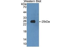 Detection of Recombinant XRN1, Rat using Polyclonal Antibody to 5'-3'Exoribonuclease 1 (XRN1)