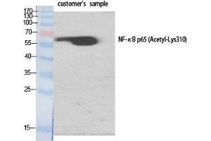 Western Blot (WB) analysis of specific cells using Acetyl-NFkappaB-p65 (K310) Polyclonal Antibody. (NF-kB p65 anticorps  (acLys310))