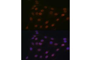 Immunofluorescence analysis of C6 cells using RanG Rabbit mAb (ABIN7269846) at dilution of 1:100 (40x lens).