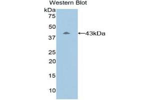 Western blot analysis of the recombinant protein. (C8B anticorps  (AA 161-503))