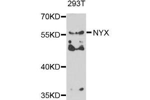 Western blot analysis of extracts of 293T cells, using NYX antibody. (Nyctalopin anticorps  (AA 282-481))