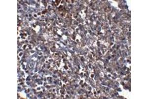 Immunohistochemistry (IHC) image for anti-ORAI Calcium Release-Activated Calcium Modulator 1 (ORAI1) antibody (ABIN1031712)