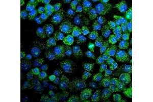 IF analysis of MAPK11 using anti-MAPK11 antibody (ABIN7600772).