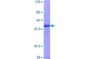 Image no. 1 for Aquaporin 2 (Collecting Duct) (AQP2) (AA 1-271) protein (GST tag) (ABIN1345422)