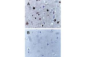 Formalin-fixed, paraffin-embedded human brain sections stained for Active/Cleaved CASP9 expression using CASP9 polyclonal antibody  at 1 : 2000. (Caspase 9 anticorps)