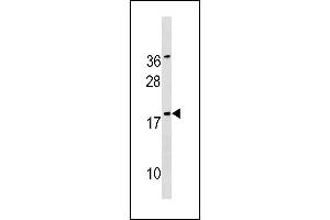 SNX12 Antibody (Center) (ABIN1881820 and ABIN2843219) western blot analysis in  cell line lysates (35 μg/lane). (SNX12 anticorps  (AA 84-112))