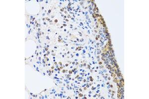 Immunohistochemistry of paraffin-embedded rat lung using MTA3 antibody (ABIN2737194) at dilution of 1:100 (40x lens). (MTA3 anticorps)