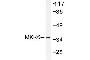 Image no. 1 for anti-Mitogen-Activated Protein Kinase Kinase 6 (MAP2K6) antibody (ABIN265521) (MAP2K6 anticorps)