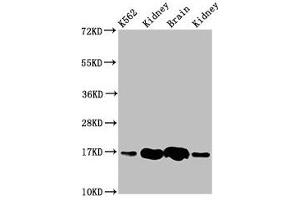 Western Blot Positive WB detected in: K562 whole cell lysate, Rat kideny tissue, Rat brain tissue, Mouse kidney tissue All lanes: HBG2 antibody at 4. (HBG2 anticorps  (AA 2-147))