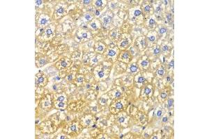 Immunohistochemistry of paraffin-embedded mouse liver using FASN Antibody.