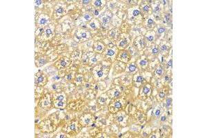 Immunohistochemistry of paraffin-embedded mouse liver using FASN Antibody. (Fatty Acid Synthase anticorps  (AA 2212-2511))