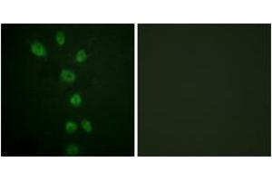 Immunofluorescence analysis of HepG2 cells, using GATA4 (Phospho-Ser105) Antibody. (GATA4 anticorps  (pSer105))