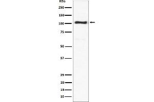 Western blot analysis of ACTN3 expression in mouse skeletal muscle lysate.