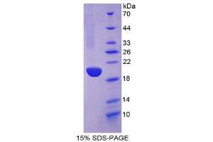 SDS-PAGE (SDS) image for Keratin 13 (KRT13) (AA 266-404) protein (His tag) (ABIN1981017)