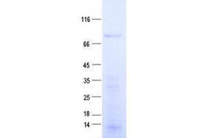 Validation with Western Blot