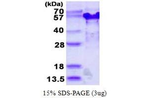 SDS-PAGE (SDS) image for Tumor Suppressing Subtransferable Candidate 4 (TSSC4) (AA 1-329) protein (His tag) (ABIN668006) (TSSC4 Protein (AA 1-329) (His tag))