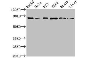 Western Blot Positive WB detected in: HepG2 whole cell lysate, Hela whole cell lysate, PC-3 whole cell lysate, K562 whole cell lyaste, Mouse brain tissue, Rat liver tissue All lanes: STAT4 antibody at 1 μg/mL Secondary Goat polyclonal to rabbit IgG at 1/50000 dilution Predicted band size: 86 kDa Observed band size: 86 kDa (STAT4 anticorps  (AA 569-748))