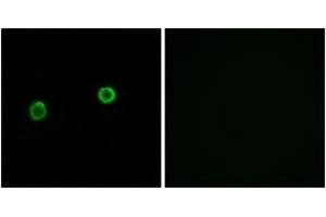 Immunofluorescence analysis of MCF7 cells, using ACOT4 Antibody. (ACOT4 anticorps  (AA 361-410))