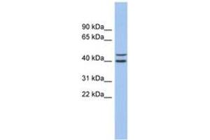 Image no. 1 for anti-F-Box and Leucine-Rich Repeat Protein 14 (FBXL14) (AA 35-84) antibody (ABIN6743688) (FBXL14 anticorps  (AA 35-84))