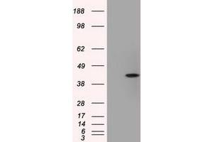 Image no. 3 for anti-Acetyl-CoA Acetyltransferase 2 (ACAT2) antibody (ABIN1496402) (ACAT2 anticorps)