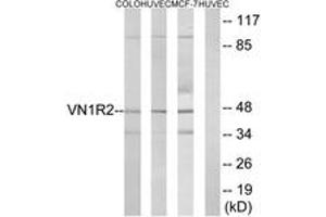 Western blot analysis of extracts from HuvEc/COLO/MCF-7 cells, using VN1R2 Antibody.